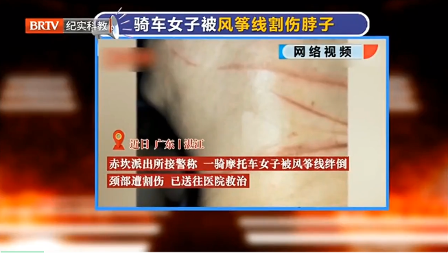 京云<a href=http://www.shengmiao.com.cn/team/ target=_blank class=infotextkey>律師</a>解讀：危險！女子騎車脖子遭風箏線割傷，放飛者應為此擔責！